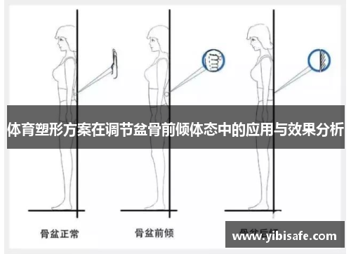 体育塑形方案在调节盆骨前倾体态中的应用与效果分析